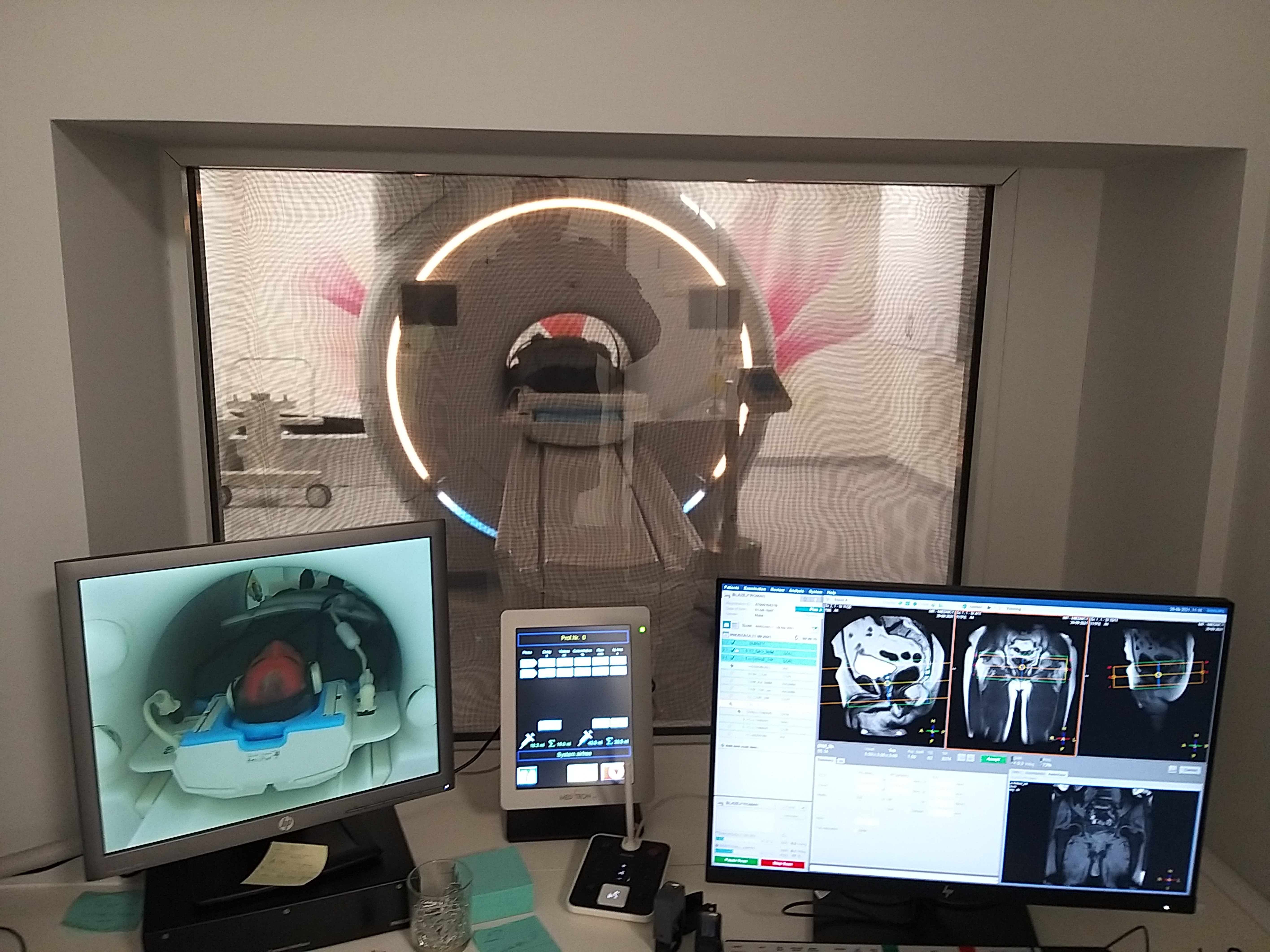 Supernowoczesny rezonans w ZOZ Nr 2 w Rzeszowie – jednostce organizacyjnej powiatu rzeszowskiego